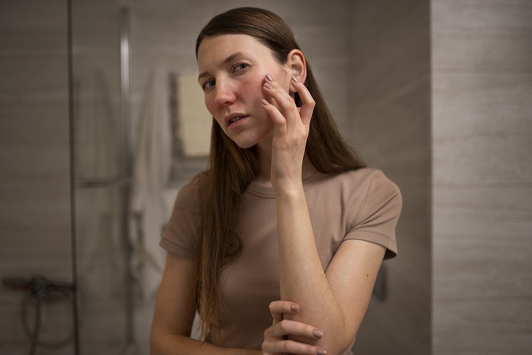 Major skin problems in Pakistan